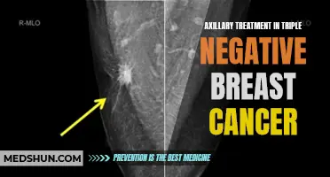 The Importance of Axillary Treatment in Triple Negative Breast Cancer: What You Need to Know