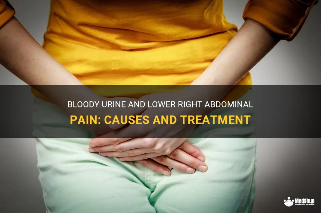 blood in urine lower right abdominal pain