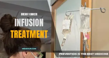 Understanding Breast Cancer Infusion Treatment: What You Need to Know