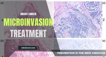 The Advancements in Treatment for Breast Cancer Microinvasion
