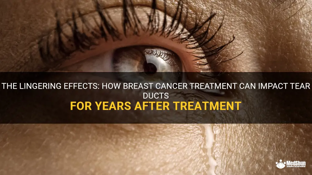 breast cancer treatment can effect tear duct years after treatment