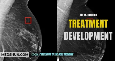 New Advances in Breast Cancer Treatment: A Look at the Latest Developments