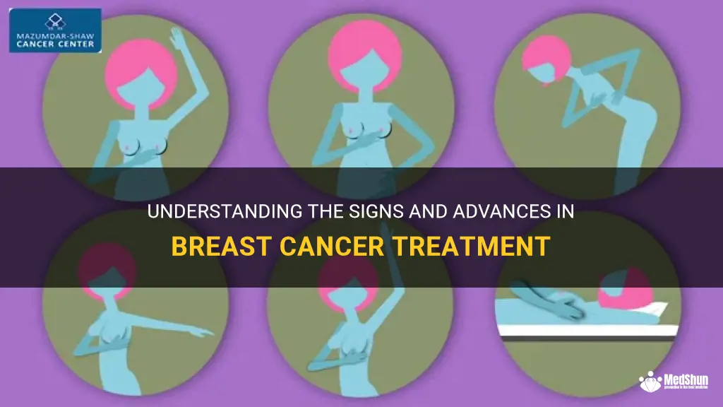 breast cancer treatment signs
