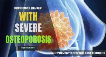 A Comprehensive Guide to Breast Cancer Treatment in Patients with Severe Osteoporosis