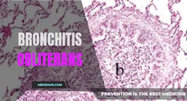 Understanding Bronchitis Obliterans: Causes, Symptoms, and Treatment Options