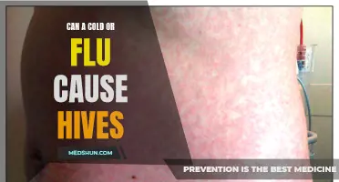 Can a Cold or Flu Lead to Hives?
