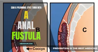 Exploring the Link: Pilonidal Cyst and Anal Fistula – Possible Connections and Complications