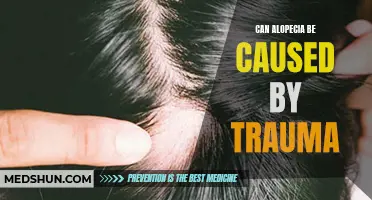 Understanding the Possible Link: Can Trauma Lead to Alopecia?