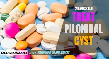Can Amoxicillin effectively treat a pilonidal cyst?