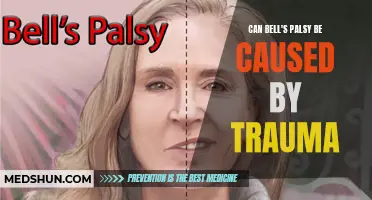 Understanding the Link Between Trauma and Bell's Palsy