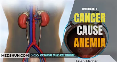 Can Bladder Cancer Lead to Anemia?