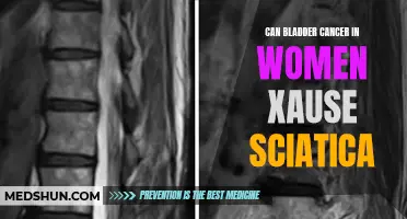 Bladder Cancer in Women: A Potential Cause of Sciatica