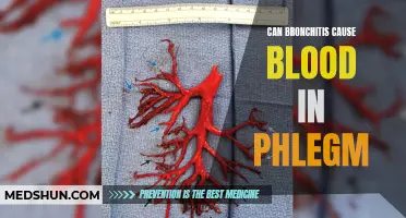 Unraveling the Link: Exploring the Potential Connection Between Bronchitis and Blood in Phlegm