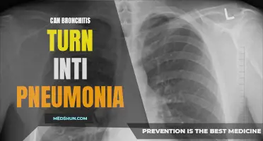 Understanding How Bronchitis Can Progress into Pneumonia