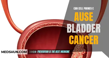 Cell Phones and Bladder Cancer: The Potential Link You Should Know
