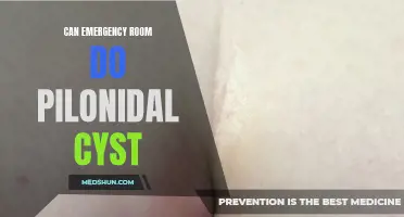 Can Emergency Rooms Treat Pilonidal Cysts?