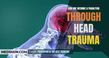 Understanding the Effects of Head Trauma: Can it Lead to Paralysis?