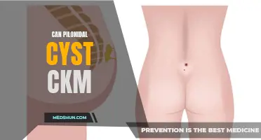 Understanding the Causes and Treatment of Pilonidal Cyst: A Comprehensive Guide
