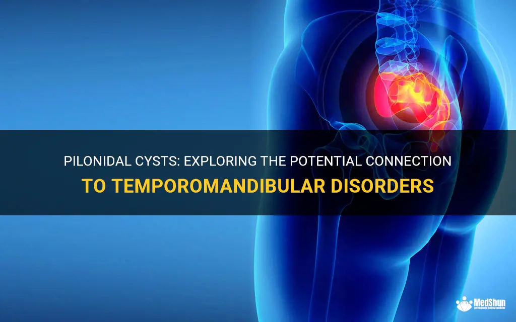 can pilonidal cysts cause tm
