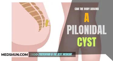 Understanding the Body's Absorption Process: Can a Pilonidal Cyst be Absorbed?