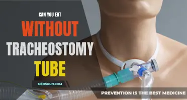 Managing Nutrition: Eating without a Tracheostomy Tube