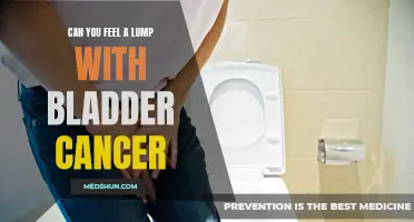 Can you feel a lump with bladder cancer? Understanding the signs and symptoms