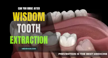 After Wisdom Tooth Extraction: Is Rinsing Allowed?