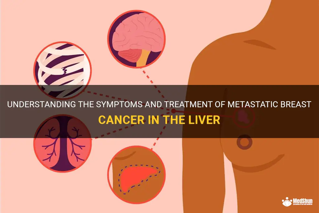 cancer treatment of metastic breast to liver symptoms