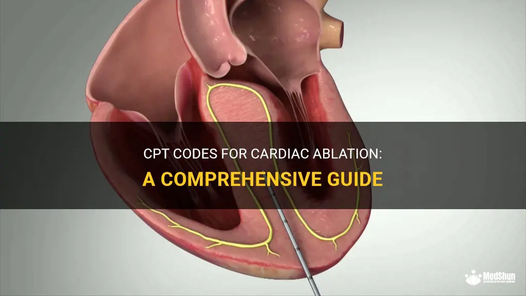 Cpt Codes For Cardiac Ablation A Comprehensive Guide MedShun