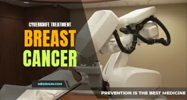 The Revolutionary CyberKnife Treatment: A New Hope for Breast Cancer Patients