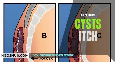 Understanding the Itching Associated with Pilonidal Cysts