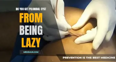 Can Laziness Lead to Pilonidal Cyst Formation?