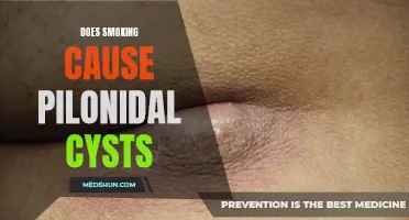 The Link Between Smoking and Pilonidal Cysts: What You Need to Know