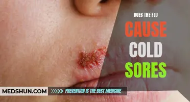 Can the Flu Virus Trigger Cold Sores?
