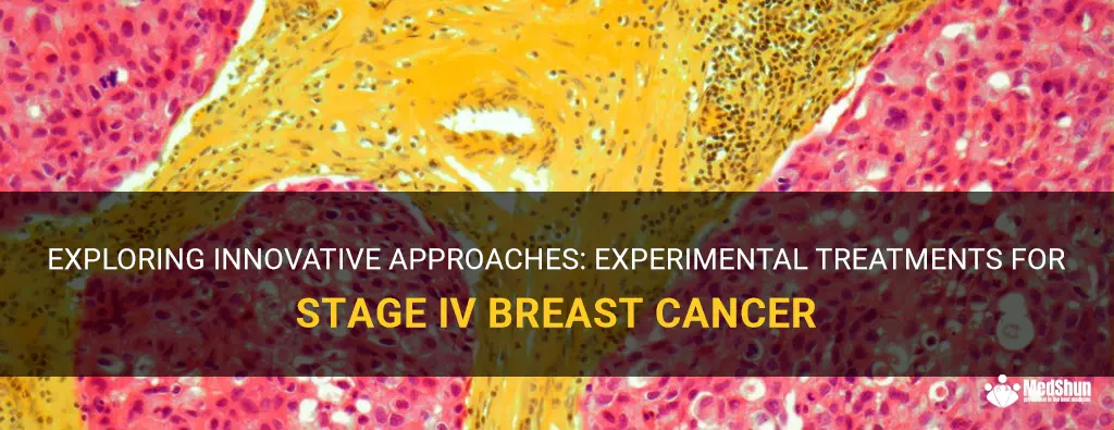experimental treatments stage iv breast cancer