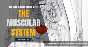 The Impact of Bladder Cancer on the Muscular System: Everything You Need to Know