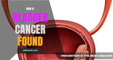 Unveiling the Diagnostic Methods Used in Detecting Bladder Cancer