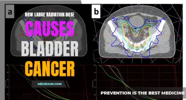 The Link between High Radiation Dose and Bladder Cancer: Exploring the Connection