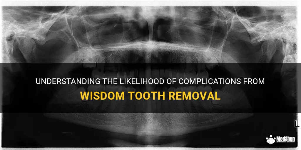 Understanding The Likelihood Of Complications From Wisdom Tooth Removal ...