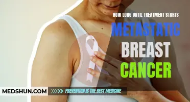 How Soon Can Treatment Begin for Metastatic Breast Cancer?