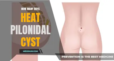 Heat Therapy: A Potential Solution for Speeding Up Pilonidal Cyst Recovery