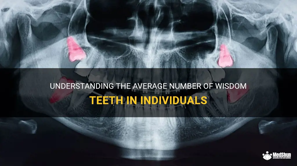 Understanding The Average Number Of Wisdom Teeth In Individuals | MedShun