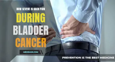 Understanding the Level of Back Pain in Relation to Bladder Cancer