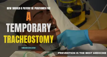 How to Properly Position a Patient for a Temporary Tracheostomy