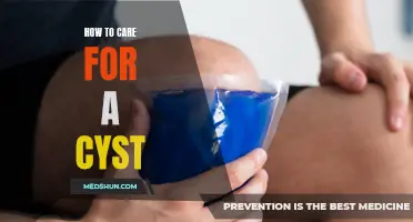 Effective Ways to Care for a Cyst and Promote Healing