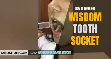 Flush Out Wisdom Tooth Socket: A Guide to Proper Care and Healing