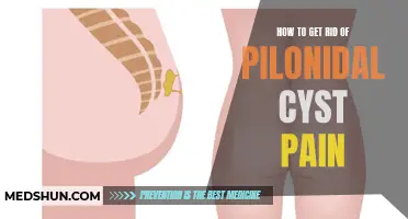 Relieve Pilonidal Cyst Pain with These Effective Strategies