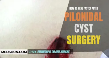 Healing Tips for a Speedy Recovery After Pilonidal Cyst Surgery