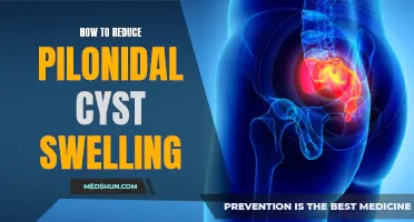 Effective Ways to Reduce Pilonidal Cyst Swelling and Discomfort