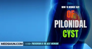 Effective Methods to Reduce the Size of a Pilonidal Cyst